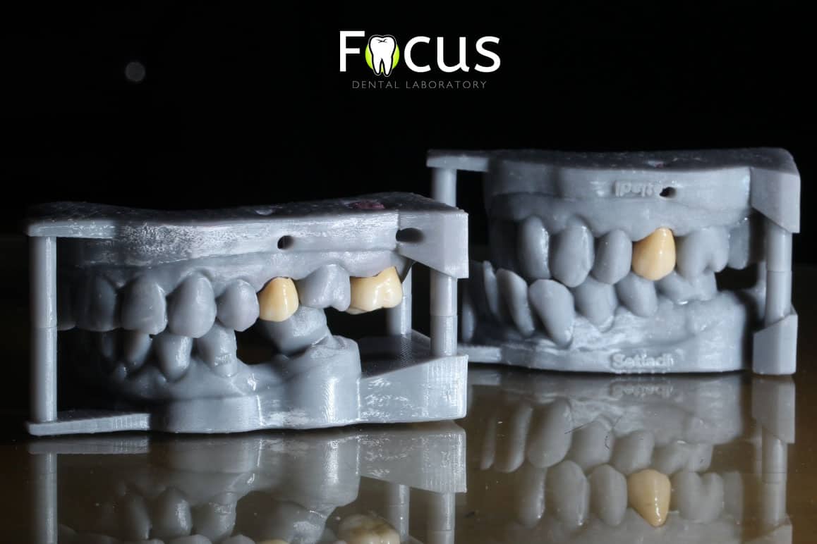 focus-dental-lab